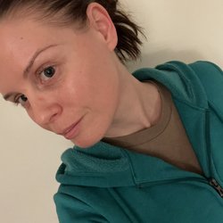 Simply Amazing Skin Care - This was my bare skin a couple days after treatment. She always makes sure it is hydrated and glowing!