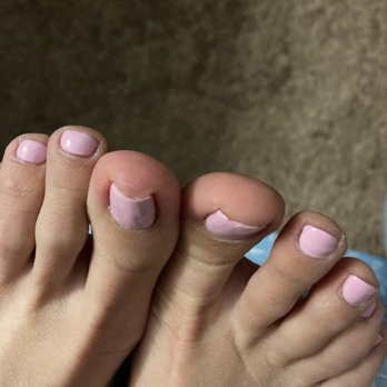 Coffee N Nails  - Regular toenail is flat. Injured toenail is bent and lifted. - Nail Salons Near Me - Austin, Texas