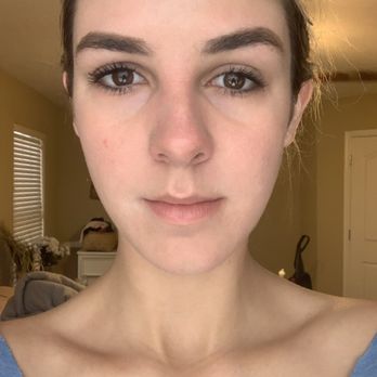 Skin Studio AZ - After 4th Session! - Skin Care Near Me - Scottsdale, Arizona Skin Studio AZ - After 4th Session! - Skin Care Near Me - Scottsdale, Arizona