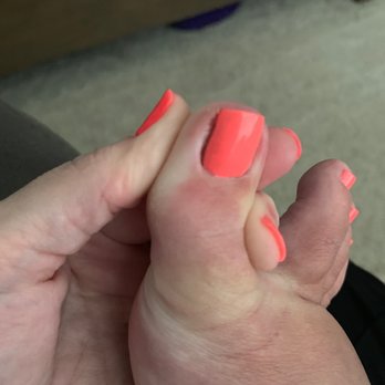 Venice Nails Salon - A day later and newly painted and you can still see the blood. It hurts - Nail Salons Near Me - Georgetown, Texas