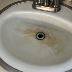 RiverPointe Post Acute - Urine in the sink