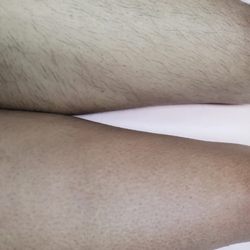 Certifiably Skinsane - Side by side sugar wax before and after