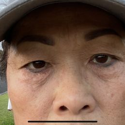Before