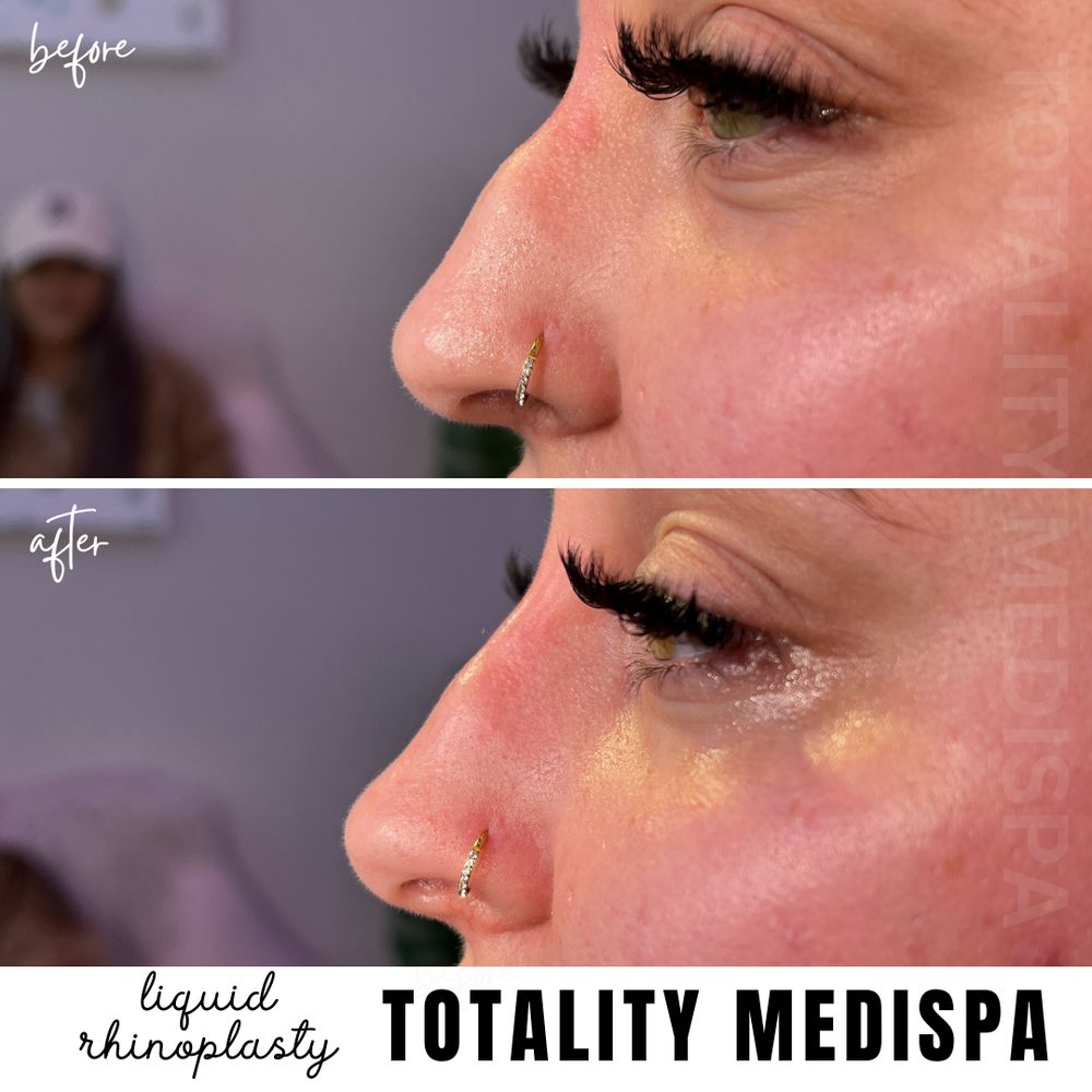 Totality Medispa Logo