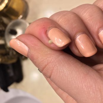 Sunset Nails - Infections! I've come here twice and each time left with getting nasty infections, the last time I got two in different fingers. - Nail Salons Near Me - San Francisco, California
