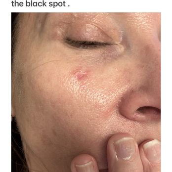 Pacific Dermatology Institute - Dermatologists Near Me - Murrieta, California Pacific Dermatology Institute - Dermatologists Near Me - Murrieta, California