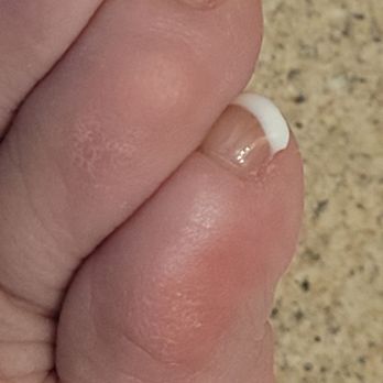 OH Nails Spa - Just left my pedicure with a boo boo on my little toe and dry skin on my feet.  No lotion or nothing!  That's a $130.00 pedicure - Nail Salons Near Me - Westerville, Ohio