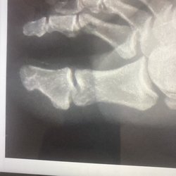 Urgent Care Wailea Makena