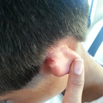 Innovators - Injured my son - Skin Care Near Me - Campbell, California