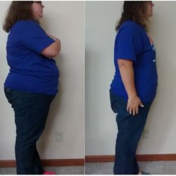 Atlantis Medical Wellness Center - Before & After  Weight Loss- 39 day protocol