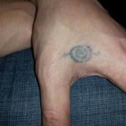 Take it Off! Spa - Take it Off! Spa #1 tattoo to remove the infamous "handmark" as I call it. lol