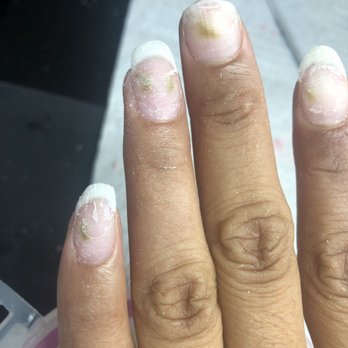 Natomas Nails - Moldy nails - Nail Salons Near Me - Sacramento, California