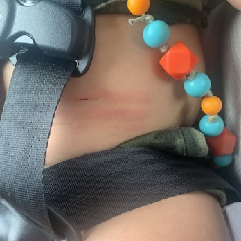 Creative Kids - Scratches noticed on the way home from daycare 6/29/21 - Child Care & Day Care Near Me - Hattiesburg, Mississippi Creative Kids - Scratches noticed on the way home from daycare 6/29/21 - Child Care & Day Care Near Me - Hattiesburg, Mississippi