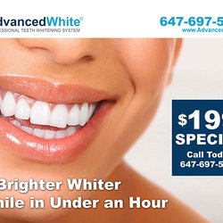 Advanced White | Professional Teeth Whitening Clinic - Advanced White Professional Laser Teeth Whitening $199 SPECIAL