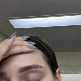 The eyebrow wax did this to my skin