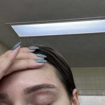 Anthony Vince Nail Spa - The eyebrow wax did this to my skin - Waxing Near Me - Miamisburg, Ohio