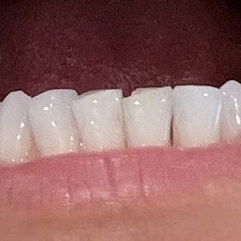 Bill Dorfman, DDS - Cosmetic Dentists Near Me - Los Angeles, California Bill Dorfman, DDS - Cosmetic Dentists Near Me - Los Angeles, California