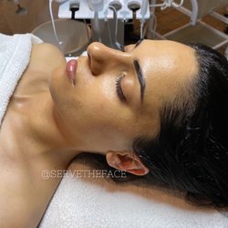 SERVETHEFACE - Post facial glow