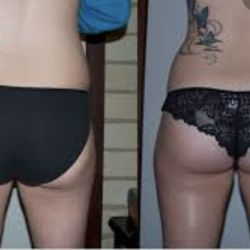 Precise Body Sculpting