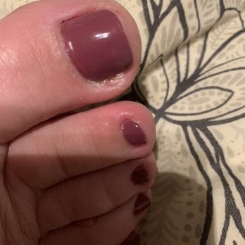 Carmichael Nails - Where the side of my toenail was cut instead of straight across at the top only. - Nail Salons Near Me - Carmichael, California