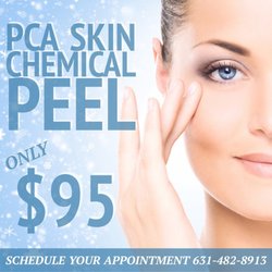 South Shore Laser - PCA Skin Chemical Peel