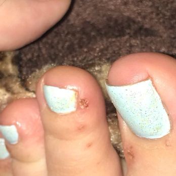 ChiChi Nails & Spa - My messed up toe, I didn't get her name and I'm kicking myself for that. But regardless, she did a horrible job! WTF?! 4 stabs! - Nail Salons Near Me - Riverside, California ChiChi Nails & Spa - My messed up toe, I didn't get her name and I'm kicking myself for that. But regardless, she did a horrible job! WTF?! 4 stabs! - Nail Salons Near Me - Riverside, California