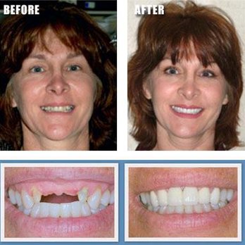 Emergency Dental & Dentures 24-7 - Dental Crowns and Dental Implants - General Dentistry Near Me - Pompano Beach, Florida Emergency Dental & Dentures 24-7 - Dental Crowns and Dental Implants - General Dentistry Near Me - Pompano Beach, Florida