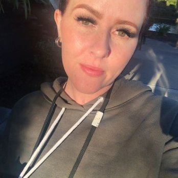 Cupertino Facial Esthetics - After first session with only brows filled in. No makeup or filter, just the glow of the sun. - Cosmetic Dentists Near Me - Cupertino, California Cupertino Facial Esthetics - After first session with only brows filled in. No makeup or filter, just the glow of the sun. - Cosmetic Dentists Near Me - Cupertino, California