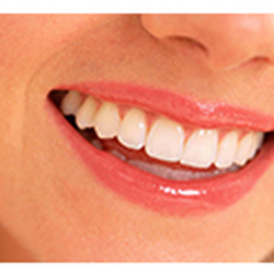 Canyon Vista Dental Care - ZOOM! Teeth Whitening