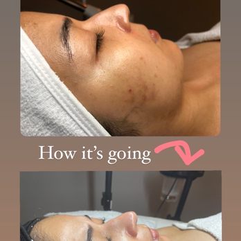 Traes Skin studio - Estheticians Near Me Traes Skin studio - Estheticians Near Me
