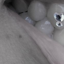 Kinoko Tooth Gems - Heart tooth gem