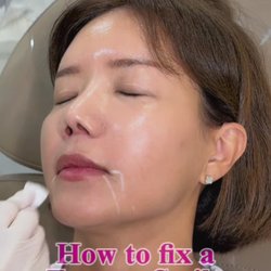 How to fix a Frowny Smile (DAO)