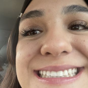 Butterfly Orthodontics - Orthodontists Near Me - Phoenix, Arizona Butterfly Orthodontics - Orthodontists Near Me - Phoenix, Arizona