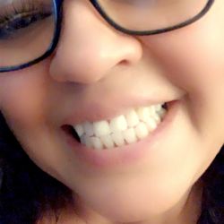 Zak Dental - Simi Valley - Front crowns and Implant !!!