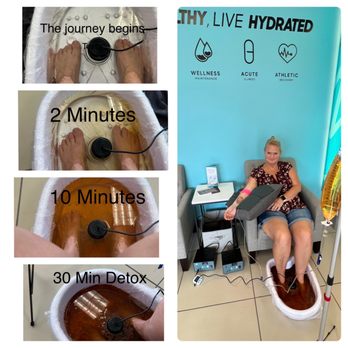 Live Hydration Spa - Me getting an IV Drip and the foot detox. This is just water with a little salt in it. The device in the middle pulled this out of me. - IV Hydration Near Me - Alcoa, Tennessee