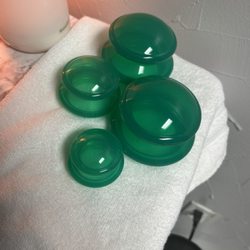 KB Massage - Cupping is available dynamic and stationary