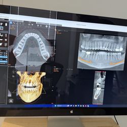 Look at the level of detail of this 3-D imaging. I mean, it was incredible to just have this opportunity for this level of clarity.