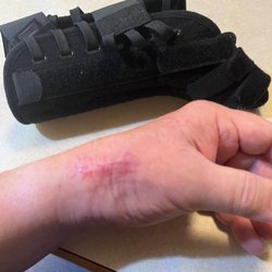 San Diego Orthopaedic Associates Medical Group - Surgery site..no more casts.