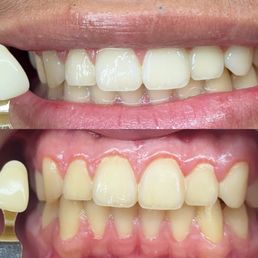 Amazing Results ! Amazing Results !
