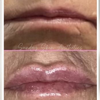 Sunday Skin Aesthetics - Aestheticians Near Me - Williston, North Dakota Sunday Skin Aesthetics - Aestheticians Near Me - Williston, North Dakota