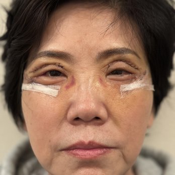 Lawton W Tang, MD - Cosmetic Surgeons Near Me - Pasadena, California Lawton W Tang, MD - Cosmetic Surgeons Near Me - Pasadena, California