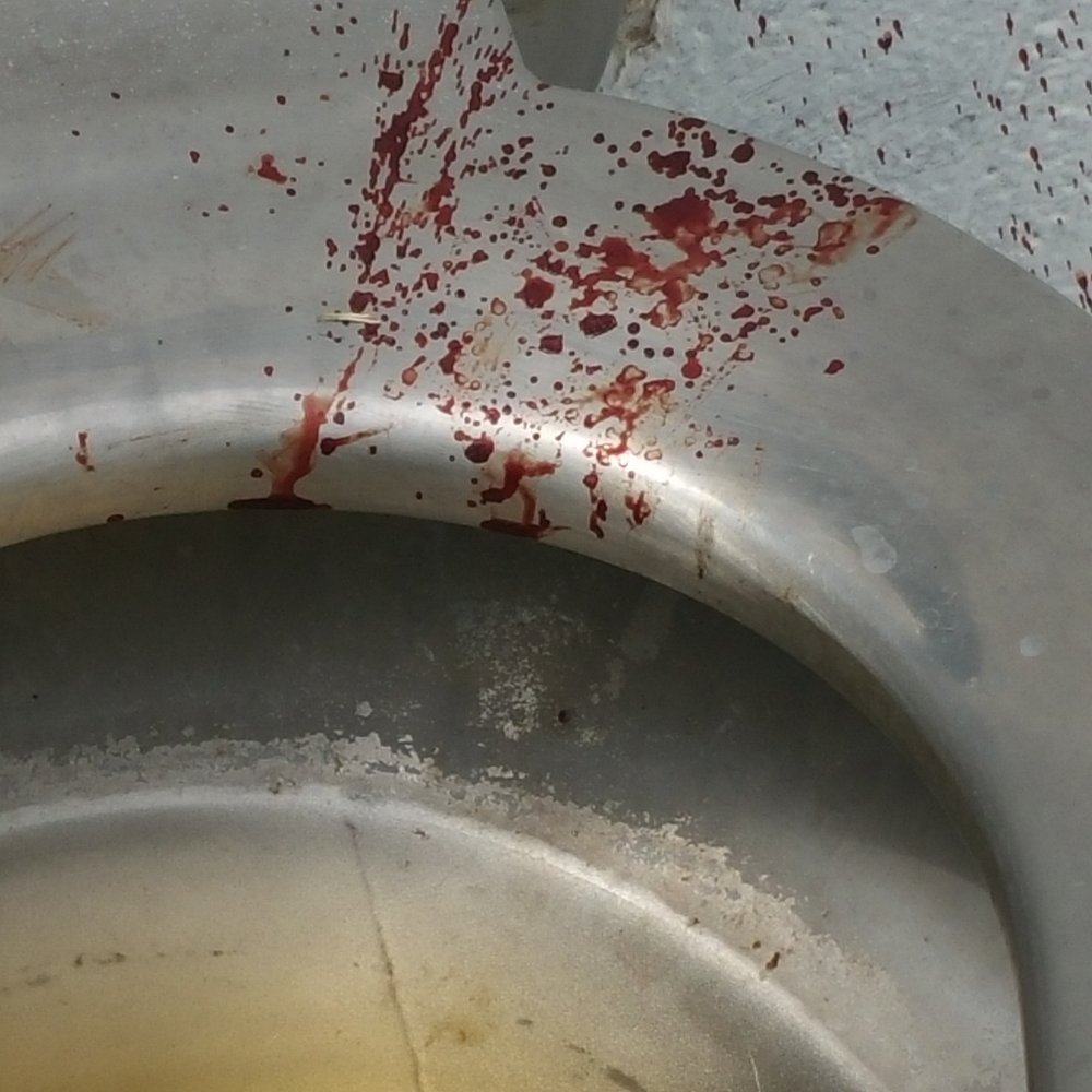 Maxey Park - The blood or what looks as such. - Parks Near Me - Lubbock, Texas