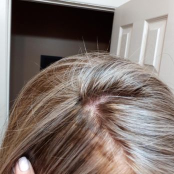 Young & Beautiful Salon-Spa - Here's the other side of my head. And my hair was 10x better than my friends!! - Hair Salons Near Me - Mississauga, Ontario Young & Beautiful Salon-Spa - Here's the other side of my head. And my hair was 10x better than my friends!! - Hair Salons Near Me - Mississauga, Ontario