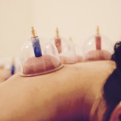 Pro SPA - Cupping