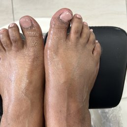 My feet looks a million times better and feels great!!!
