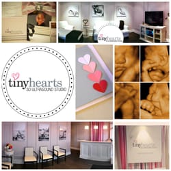 Tiny Hearts 3D Ultrasound Studio - FIrst + Only BOUTIQUE 3D Ultrasound Studio. Oakville