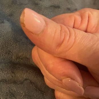 Nails Care - Every nail in this picture chipped - Nail Salons Near Me - Houston, Texas