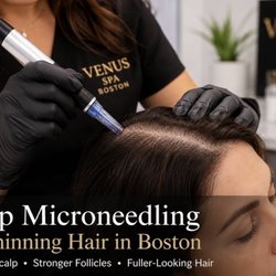Venus Spa - Scalp microneedling in Boston to support a healthier scalp and fuller-looking hair. Personalized treatments at Venus Spa.
