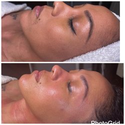 Jules Skin Studio - Before and after of facial experience