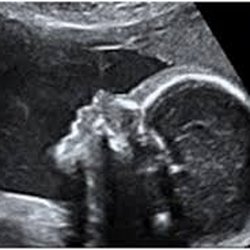 Womb in Bloom